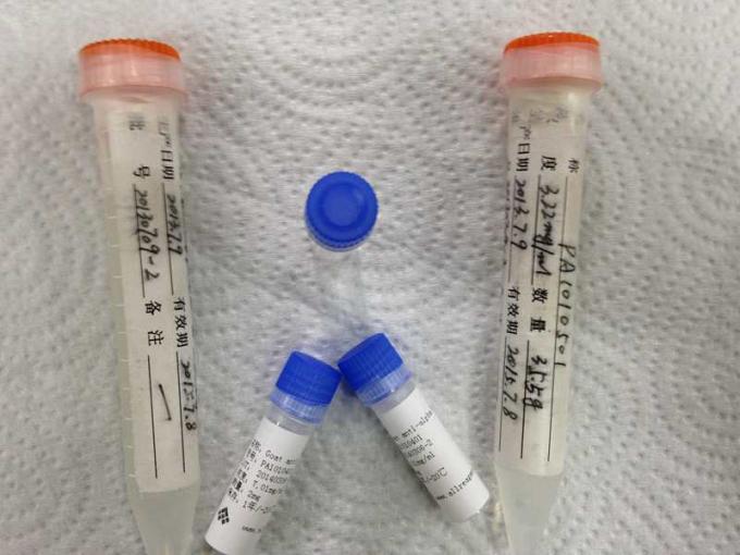 Anti - HBcAg Mouse Mab Hybridoma Monoclonal Antibody For IVD Manufacture