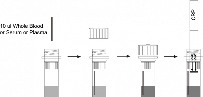 OnOne Step Strep A Rapid Test Kits Dipstick (Control Line in Red) high sensitivity with Throat Swab