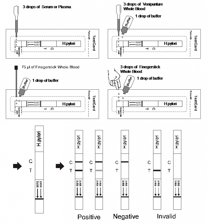 H.pylori Antibody Lateral Flow Immunochromatographic Assays Strips , Whole Blood / Serum / Plasma