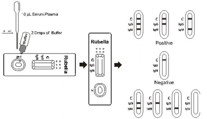 AllTest Rapid Test Kits For The Qualitative Detection Of IgG And IgM Antibodies To Rubella