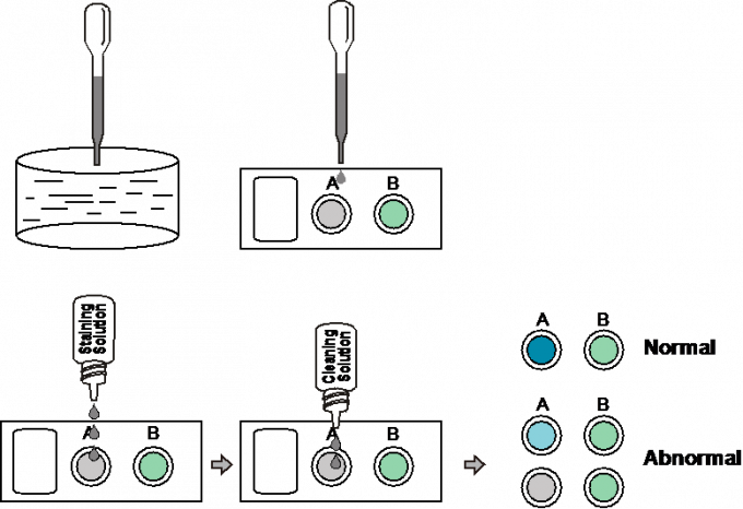 High sensitivity Sperm Concentration Rapid Test Cassette Safety