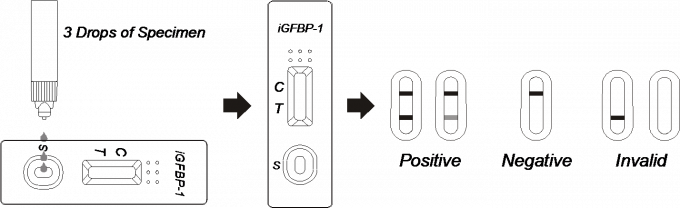 Lateral Flow Immunochromatographic Assays AllTest iGFBP-1 Rapid Test Cassette in Vaginal Discharge