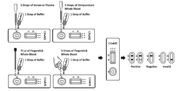 99.6% Accuracy CK-MB Rapid Test Kits One Step Diagnosis within 10 mins