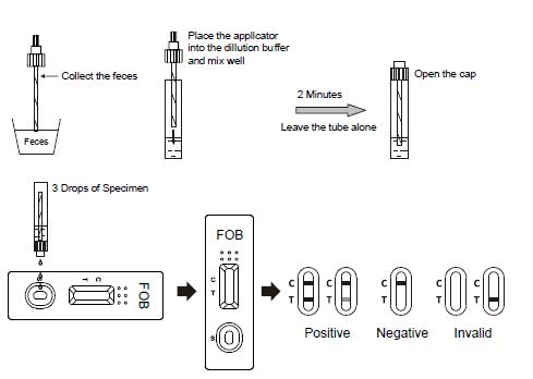 Cryptosporidium and Giardia Lamblia Combo Rapid diagnostic Test with CE