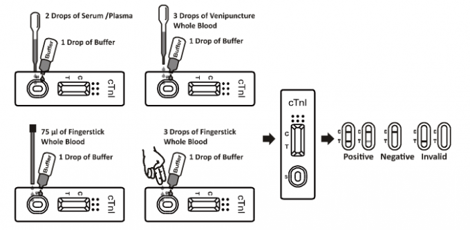 Medical Rapid Diagnostic Test Cardiac Troponin I (cTnI) Rapid Test For Acute Coronary Syndrome With CE