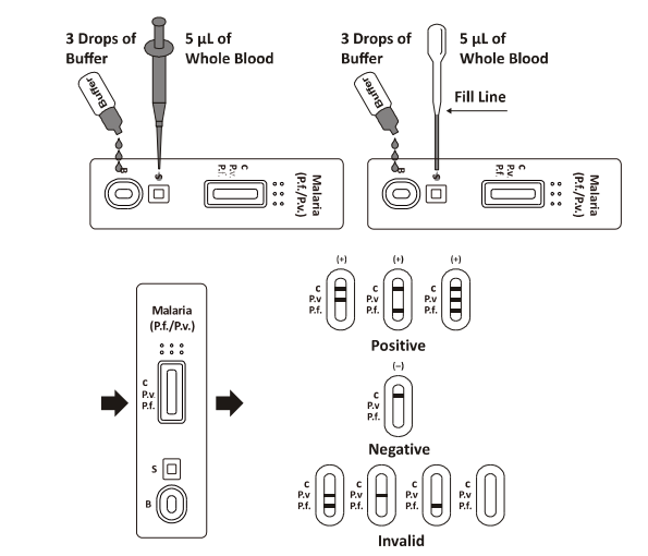 Malaria P.f. / P.v. Rapid Test Cassette , Rapid Diagnosis Test