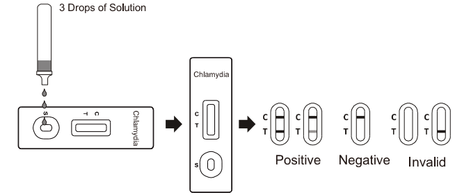 High Sensitivity Streptococcus pyogenes Test Kit Use By Novatrend fluorescence Immunoassay Analyzer In Human Swab