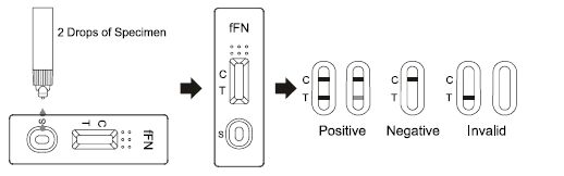Fetal Fibronectin Rapid Test Cassette , 25t Rapid Response Drug Test Kit