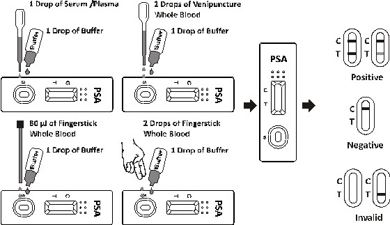 High Standard Fluorescence Immunoassay Analyzer PSA Rapid Test Kits Easy To Use
