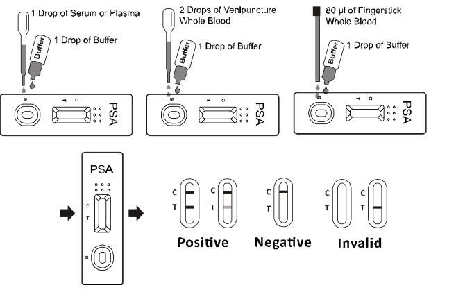 Medical Diagnosis Prostate specific antigen (PSA) Qualitative Rapid Test Kits For Prostate Cancer Risk With CE0123