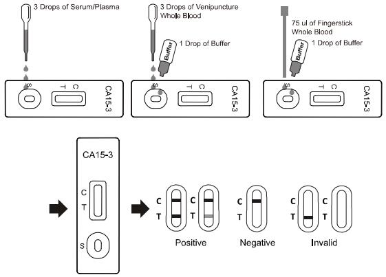 Convenient Rapid Assay Test CE Marked For Carcinoma Antigen 15-3 With High Sensitivity