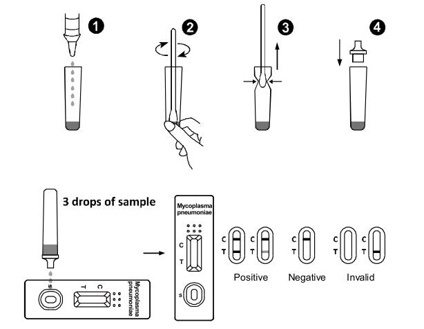 Mycoplasma Pneumoniae Antigen Lateral Flow Immunochromatographic Assays Rapid Test