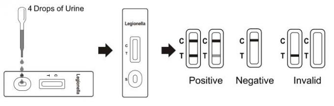 Legionella pneumophila Rapid Test Cassette (Urine)