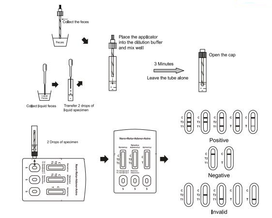 CE Rdt Kit Norovirus Rotavirus Adenovirus And Astrovirus Combo Diagnostic Test