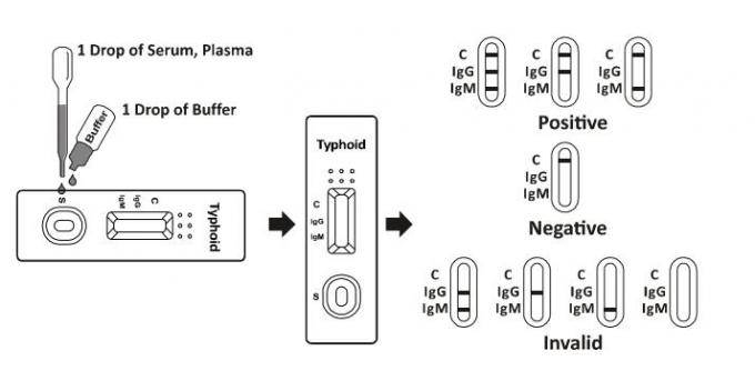 Rapid Test Kits Lateral Flow Immunochromatographic Assays Typhoid Rapid Test Cassette ( Serum / Plasma )