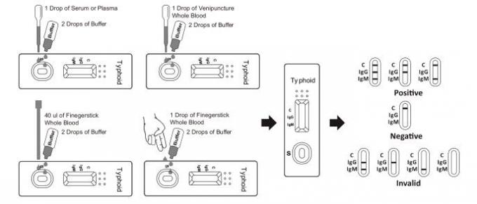 IgM / IgG Typhoid Rapid Test Kits 96.5% Accuracy with Colored Line (Whole Blood/Serum/Plasma)