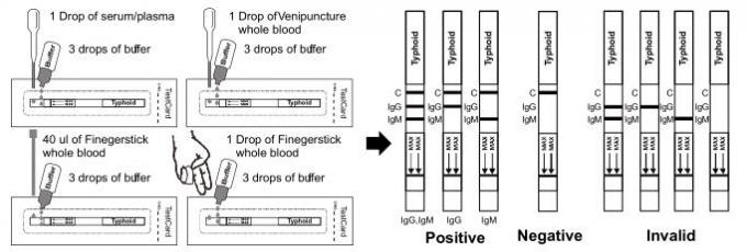 Typhoid Rapid Test Dipstick/Strips (Whole Blood/Serum/Plasma)
