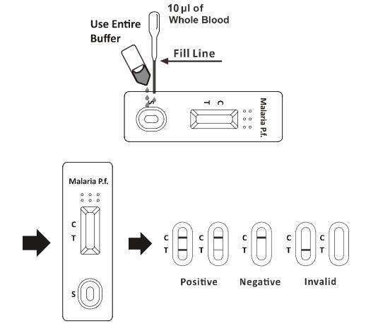 Malaria p.f. Rapid Test Kits For Circulating Antigens Qualitative Detection