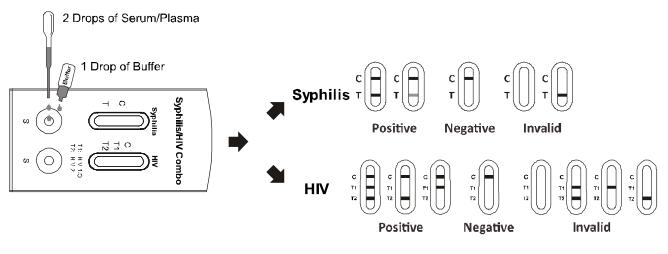 AllTest Syphilis / HIV 1.2.O Combo Rapid Test Kits Infectious Disease