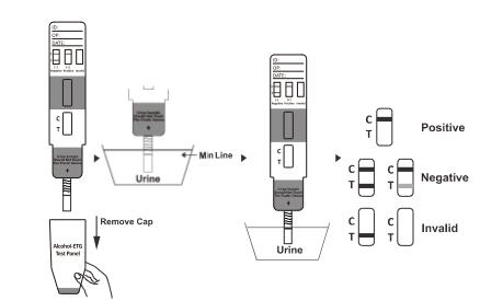 Cassette/Dipstick/Panel Ethyl Glucuronide (ETG) urine 500 ng/mL*1000 ng/mL Rapid Drug Abuse Test Kit For The Diagnosis