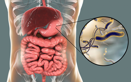 Latest company news about Helicobacter pylori: Unraveling the Hidden Culprit in Stomach Health