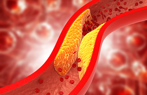 Latest company news about Decoding Cholesterol: Your Path to a Healthy Body