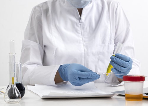 Latest company news about What Can Urine Reveal About Your Health?