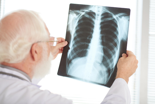 Latest company news about For TB Prevention, What we should know?