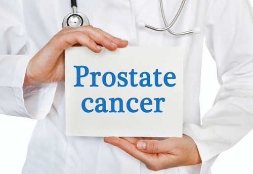 Latest company news about Prostate Cancer: A Growing Men's Health Concern Worldwide