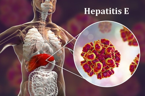 Latest company news about Viral Threat to Reproduction: The Unseen Dangers of Hepatitis E