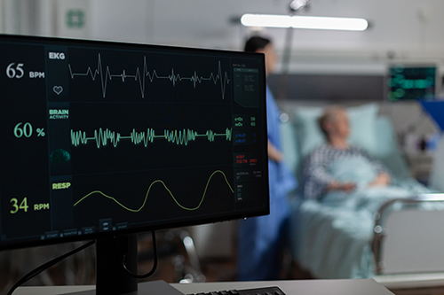 Latest company blogs about Understanding Atrial Fibrillation (AFib)