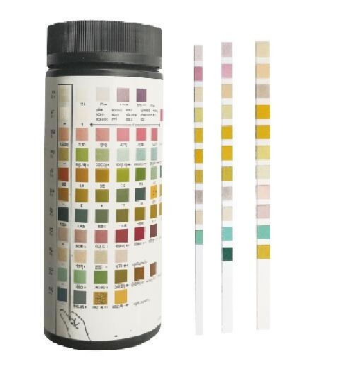 Latest company news about What should not appear in urine after a Urinalysis?