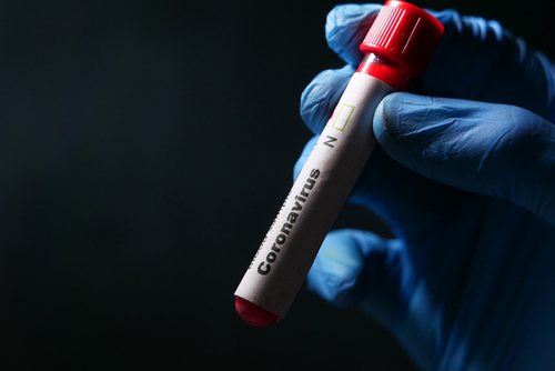 Latest company news about SARS-CoV-2 Cycle Threshold: A Metric That Matters (or Not)