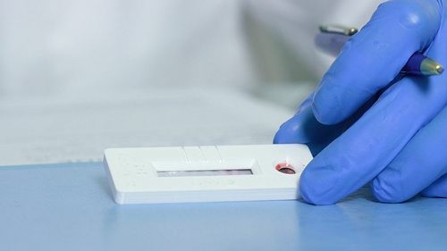 Latest company news about Recommendations on Uses and Limitations of COVID-19 Antibody Tests