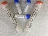 Purified HIV 41 Recombinant Gene Antigen for IVD Research